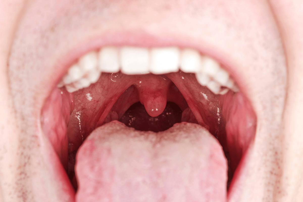 Oral Microbiome